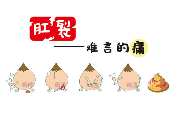 肛裂的饮食治疗与保健有哪些?广州东大医院收费怎么样