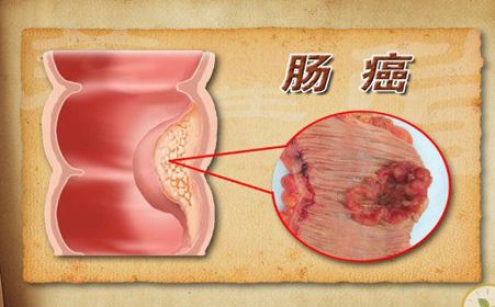 广州东大医院提醒: