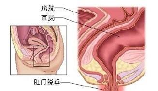 1531cc505P-134R9.jpg