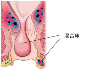 7-1605291F10a15.png
