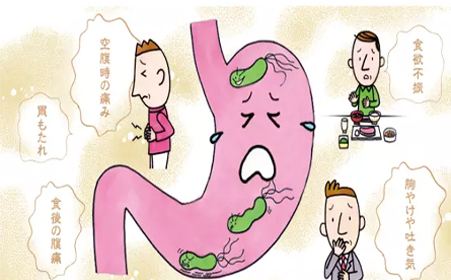 广州东大医院评价:究竟胃窦炎伴糜烂是胃溃疡吗