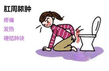 广州东大肛肠医院——肛周脓肿.jpg