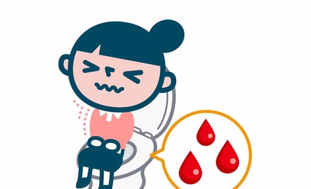 广州东大肛肠医院——痔疮.jpg